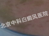 ư