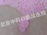 пư