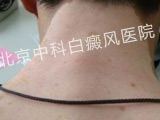 пưҽԺ