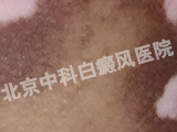 пư